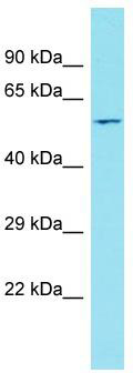 Host: Rabbit; Target Name: GPATCH3; Sample Tissue: Hela Whole cell lysates; Antibody Dilution: 1.0 ug/ml