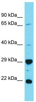 Host: Rabbit; Target Name: HAUS2; Sample Tissue: 721_B Whole Cell lysates; Antibody Dilution: 1.0 ug/ml