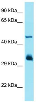 Gel: 8%SDS-PAGE<br>Lysate: 40 μg<br>Lane 1-7: Hela<br>Jurkat<br>Raji<br>293T<br>HepG2<br>K562<br>MCF-7 cell lysates<br>Primary antibody: TA367521 (PRDX4 Antibody) at dilution 1/800<br>Secondary antibody: Goat anti rabbit IgG at 1/5000 dilution<br>Exposure time: 10 seconds