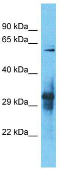 Host: Rabbit; Target Name: IGLON5; Sample Tissue: 721_B Whole cell lysates; Antibody Dilution: 1.0 ug/ml