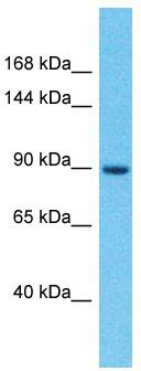 Host: Rabbit; Target Name: IGSF22; Sample Tissue: PANC1 Whole cell lysates; Antibody Dilution: 1.0 ug/ml