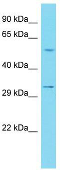 Host: Rabbit; Target Name: ILDR2; Sample Tissue: 721_B Whole Cell lysates; Antibody Dilution: 1.0 ug/ml