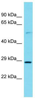 Host: Rabbit; Target Name: ITPRIPL2; Sample Tissue: Hela Whole Cell lysates; Antibody Dilution: 1.0 ug/ml