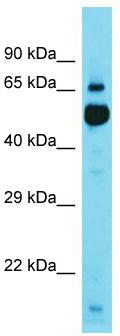 Gel: 6%SDS-PAGE<br>Lysate: 40 μg<br>Lane: Mouse brain tissue<br>Primary antibody: TA367542 (NOS1 Antibody) at dilution 1/200<br>Secondary antibody: Goat anti rabbit IgG at 1/8000 dilution<br>Exposure time: 1 minute