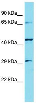 Host: Rabbit; Target Name: KLHL30; Sample Tissue: Hela Whole Cell lysates; Antibody Dilution: 1.0 ug/ml