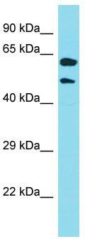 Host: Rabbit; Target Name: KRT39; Sample Tissue: RPMI-8226 Whole Cell lysates; Antibody Dilution: 1.0 ug/ml