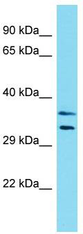 Host: Rabbit; Target Name: LMOD3; Sample Tissue: HCT15 Whole Cell lysates; Antibody Dilution: 1.0 ug/ml