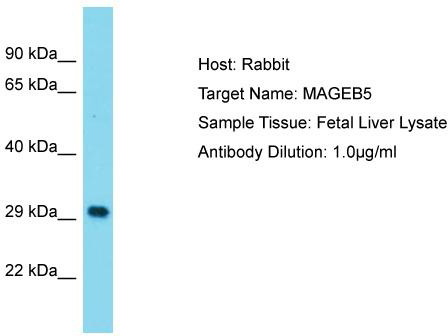 Host: Rabbit; Target Name: MAGEB5; Sample Tissue: Fetal Liver lysates; Antibody Dilution: 1.0 ug/ml