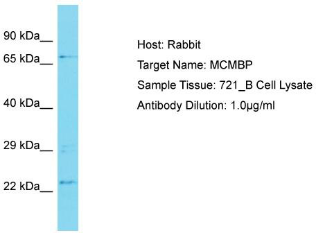 Host: Rabbit; Target Name: MCMBP; Sample Tissue: 721_B Whole Cell lysates; Antibody Dilution: 1.0 ug/ml MCMBP is supported by BioGPS gene expression data to be expressed in 721_B