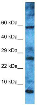 Host: Rabbit; Target Name: MRPL52; Sample Tissue: Hela Whole Cell lysates; Antibody Dilution: 1.0 ug/ml