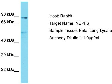 Host: Rabbit; Target Name: NBPF6; Sample Tissue: Fetal Lung lysates; Antibody Dilution: 1.0 ug/ml