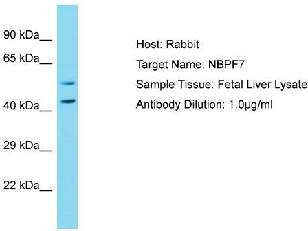 Host: Rabbit; Target Name: NBPF7; Sample Tissue: Fetal Liver lysates; Antibody Dilution: 1.0 ug/ml