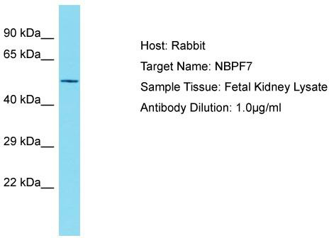 Host: Rabbit; Target Name: NBPF7; Sample Tissue: Fetal Kidney lysates; Antibody Dilution: 1.0 ug/ml