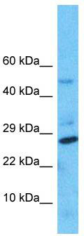 Host: Rabbit; Target Name: NUDT8; Sample Tissue: HepG2 Whole Cell lysates; Antibody Dilution: 1.0 ug/ml