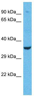 Host: Rabbit; Target Name: OR1L1; Sample Tissue: A549 Whole Cell lysates; Antibody Dilution: 1.0 ug/ml