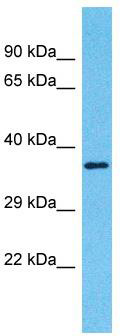 Host: Rabbit; Target Name: OR2A42; Sample Tissue: Fetal Kidney lysates; Antibody Dilution: 1.0 ug/ml