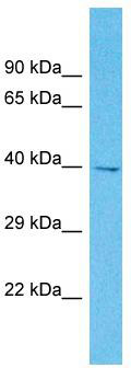 Host: Rabbit; Target Name: OR2M2; Sample Tissue: OVCAR-3 Whole Cell lysates; Antibody Dilution: 1.0 ug/ml