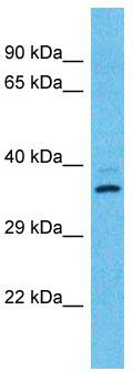 Host: Rabbit; Target Name: OR2T12; Sample Tissue: HT1080 Whole Cell lysates; Antibody Dilution: 1.0 ug/ml