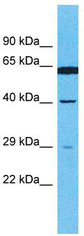 Host: Rabbit; Target Name: OR4E2; Sample Tissue: MCF7 Whole Cell lysates; Antibody Dilution: 1.0 ug/ml