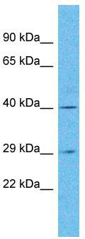 Host: Rabbit; Target Name: OR4N5; Sample Tissue: Jurkat Whole Cell lysates; Antibody Dilution: 1.0 ug/ml