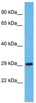 Host: Rabbit; Target Name: OR5H14; Sample Tissue: Jurkat Whole Cell lysates; Antibody Dilution: 1.0 ug/ml