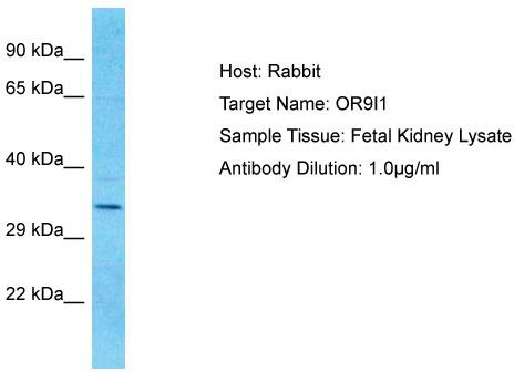 Host: Rabbit; Target Name: OR9I1; Sample Tissue: Fetal Kidney lysates; Antibody Dilution: 1.0ug/ml
