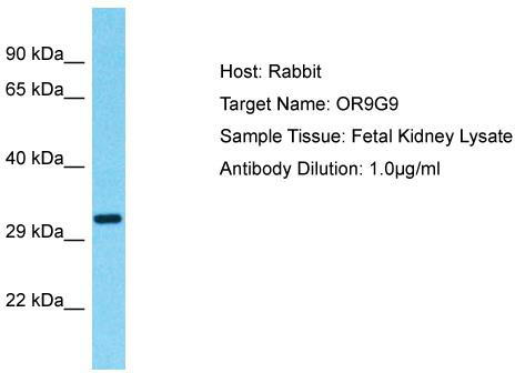 Host: Rabbit; Target Name: OR9G9; Sample Tissue: Fetal Kidney lysates; Antibody Dilution: 1.0ug/ml