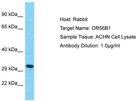Host: Rabbit; Target Name: OR56B1; Sample Tissue: ACHN Whole Cell lysates; Antibody Dilution: 1.0ug/ml