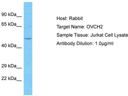 Host: Rabbit; Target Name: OVCH2; Sample Tissue: Jurkat Whole Cell lysates; Antibody Dilution: 1.0ug/ml
