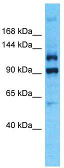 Host: Rabbit; Target Name: PLEKHG4B; Sample Tissue: Hela Whole Cell lysates; Antibody Dilution: 1.0ug/ml