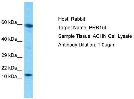 Host: Rabbit; Target Name: PRR15L; Sample Tissue: ACHN Whole Cell lysates; Antibody Dilution: 1.0ug/ml