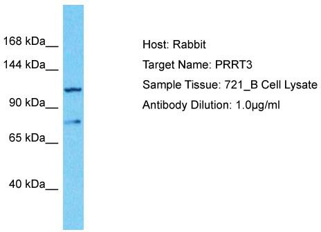 Host: Rabbit; Target Name: PRRT3; Sample Tissue: 721_B Whole Cell lysates; Antibody Dilution: 1.0ug/ml