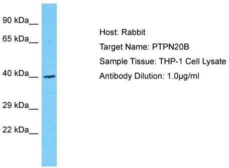 Host: Rabbit; Target Name: PTPN20B; Sample Tissue: THP-1 Whole Cell lysates; Antibody Dilution: 1.0ug/ml