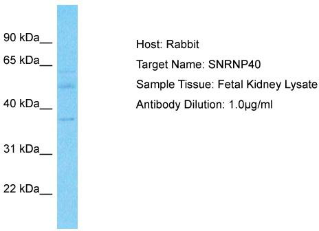 Host: Rabbit; Target Name: SNRNP40; Sample Tissue: Fetal Kidney lysates; Antibody Dilution: 1.0ug/ml