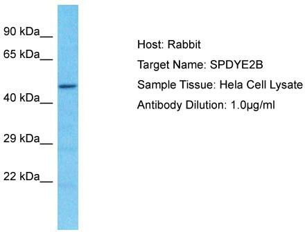 Host: Rabbit; Target Name: SPDYE2B; Sample Tissue: Hela Whole Cell lysates; Antibody Dilution: 1.0ug/ml