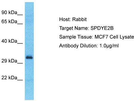 Host: Rabbit; Target Name: SPDYE2B; Sample Tissue: MCF7 Whole Cell lysates; Antibody Dilution: 1.0ug/ml
