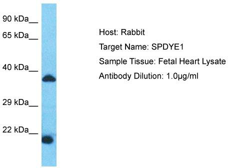 Host: Rabbit; Target Name: SPDYE1; Sample Tissue: Fetal Heart lysates; Antibody Dilution: 1.0ug/ml