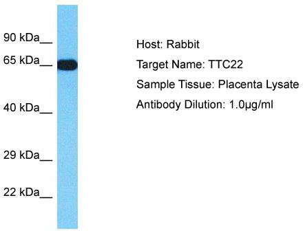 Host: Rabbit; Target Name: TTC22; Sample Tissue: Placenta lysates; Antibody Dilution: 1.0ug/ml