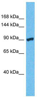 Host: Rabbit; Target Name: VEPH1; Sample Tissue: Hela Whole Cell lysates; Antibody Dilution: 1.0ug/ml
