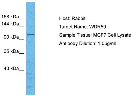 Host: Rabbit; Target Name: WDR59; Sample Tissue: MCF7 Whole Cell lysates; Antibody Dilution: 1.0ug/ml; WDR59 is strongly supported by BioGPS gene expression data to be expressed in Human MCF7 cells