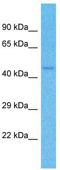 Host: Rabbit; Target Name: ZNF772; Sample Tissue: Jurkat Whole Cell lysates; Antibody Dilution: 1.0ug/ml