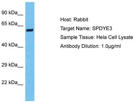 Host: Rabbit; Target Name: SPDYE3; Sample Tissue: Hela Whole Cell lysates; Antibody Dilution: 1.0ug/ml