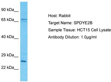 Host: Rabbit; Target Name: SPDYE2B; Sample Tissue: HCT15 Whole Cell lysates; Antibody Dilution: 1.0ug/ml