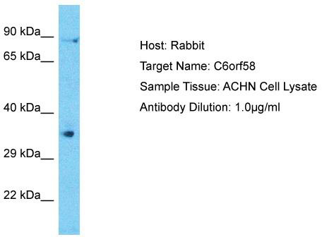 Host: Rabbit; Target Name: C6orf58; Sample Tissue: ACHN Whole Cell lysates; Antibody Dilution: 1.0ug/ml