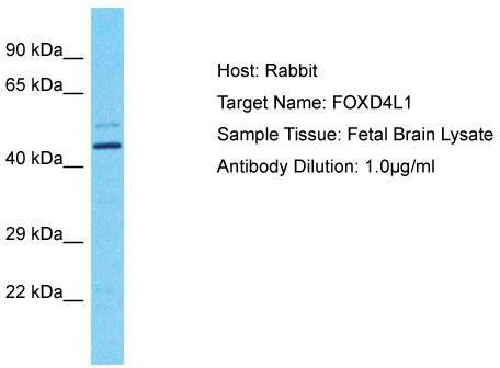 Host: Rabbit; Target Name: FOXD4L1; Sample Tissue: Fetal Brain lysates; Antibody Dilution: 1.0ug/ml