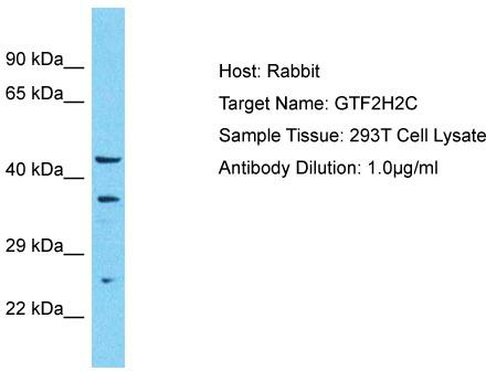 Host: Rabbit; Target Name: GTF2H2C; Sample Tissue: 293T Whole Cell lysates; Antibody Dilution: 1.0ug/ml