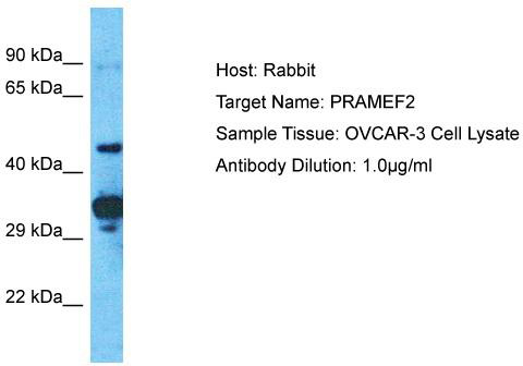 Host: Rabbit; Target Name: PRAMEF2; Sample Tissue: OVCAR-3 Whole Cell lysates; Antibody Dilution: 1.0ug/ml