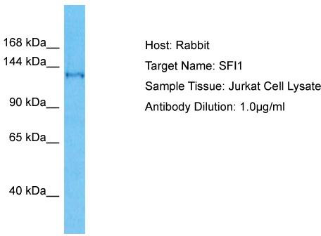 Host: Rabbit; Target Name: SFI1; Sample Tissue: Jurkat Whole Cell lysates; Antibody Dilution: 1.0ug/ml