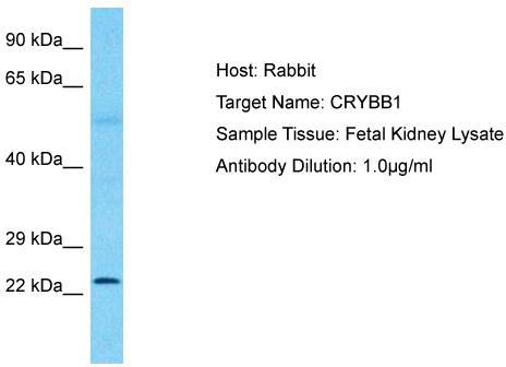 Host: Rabbit; Target Name: CRYBB1; Sample Tissue: Fetal Kidney lysates; Antibody Dilution: 1.0ug/ml