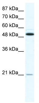WB Suggested Anti-TNFRSF11B Antibody Titration: 1.25 ug/ml; ELISA Titer: 1:312500; Positive Control: HepG2 cell lysate